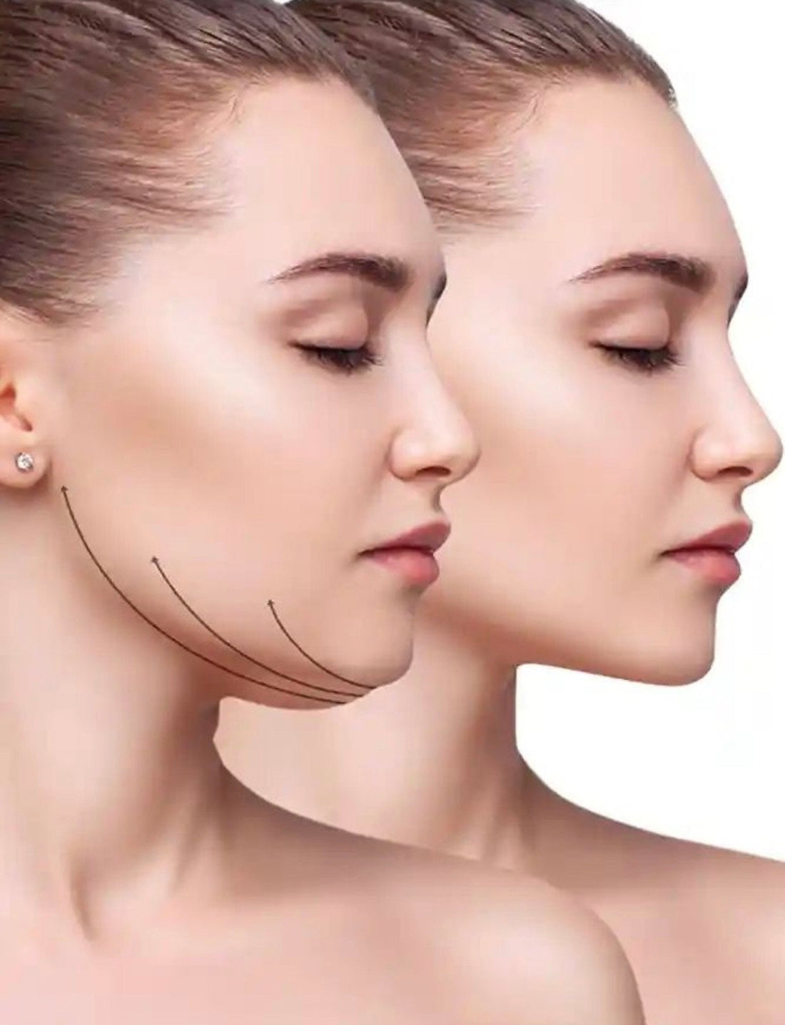 How to Get Rid of a Double Chin with At-Home Devices